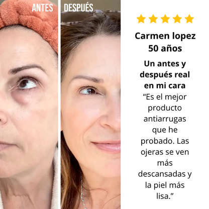 Piel Joven en Tiempo Récord sin Agujas